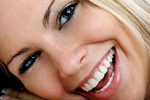 teeth-whitening-preston